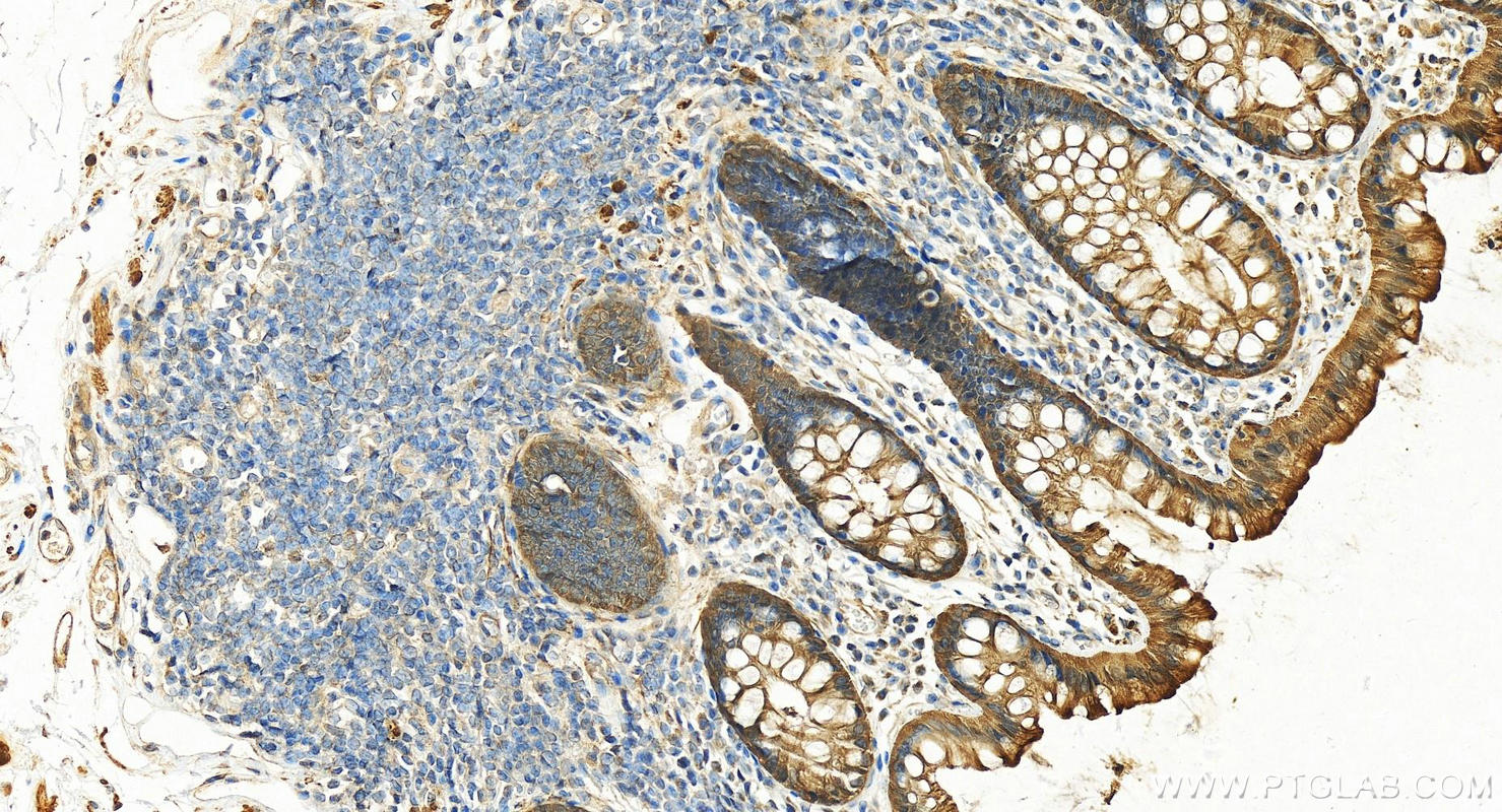 IHC staining of human normal colon using 18713-1-AP