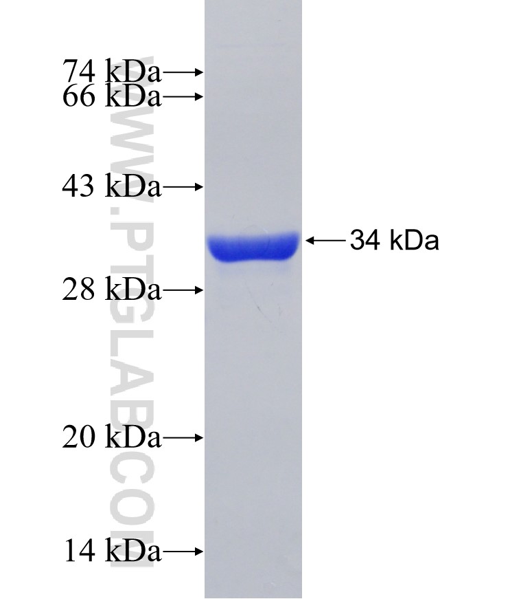 CKS2 fusion protein Ag31085 SDS-PAGE