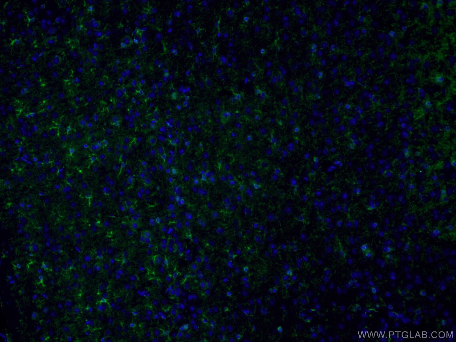 IF Staining of mouse brain using 12942-1-AP