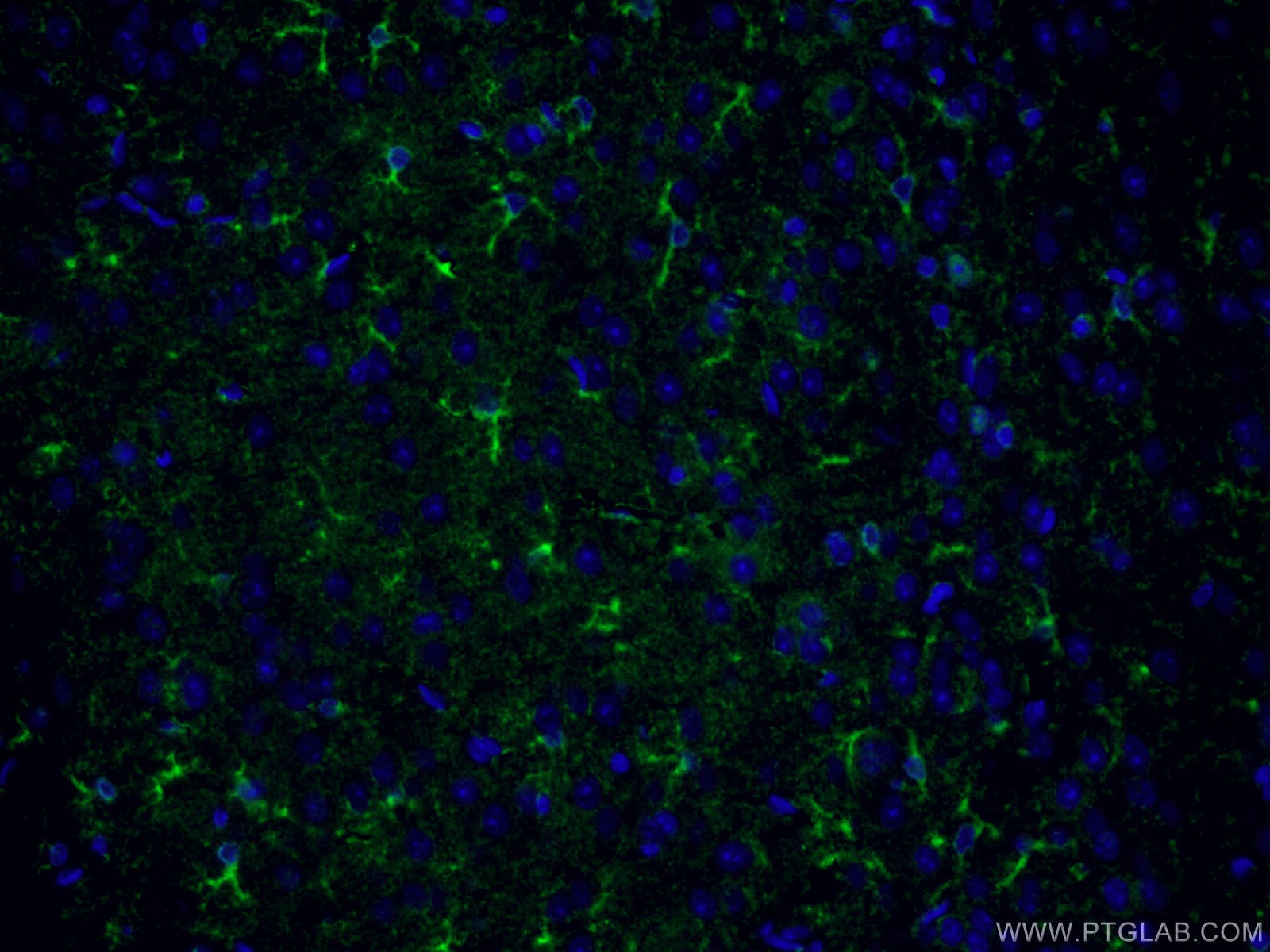 IF Staining of mouse brain using 12942-1-AP