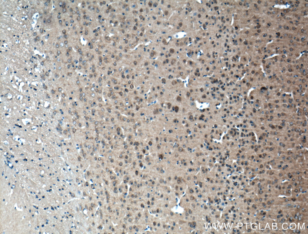 IHC staining of mouse brain using 12942-1-AP