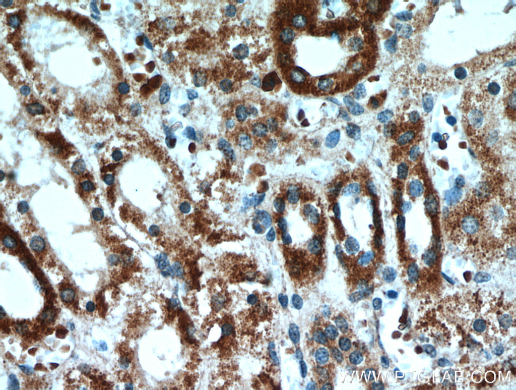 IHC staining of human kidney using 21013-1-AP