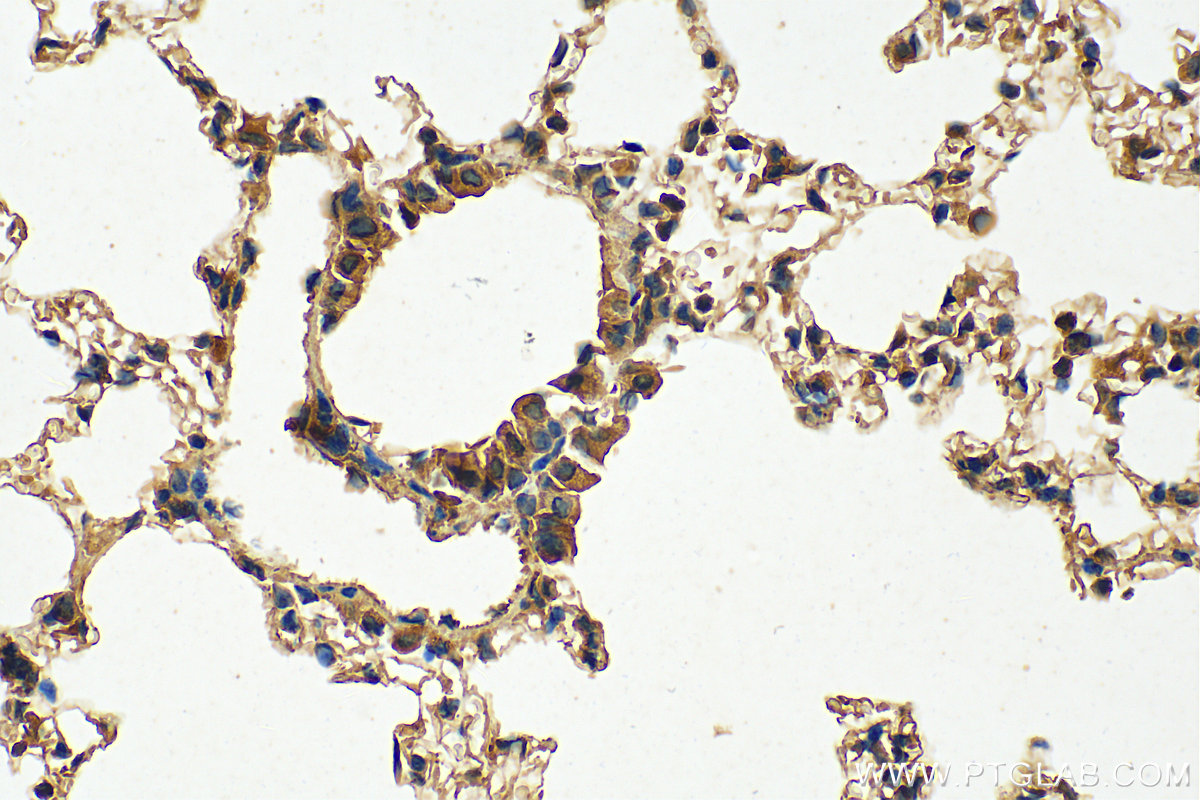 IHC staining of mouse lung using 13394-1-AP