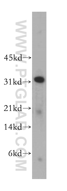 CLEC1A