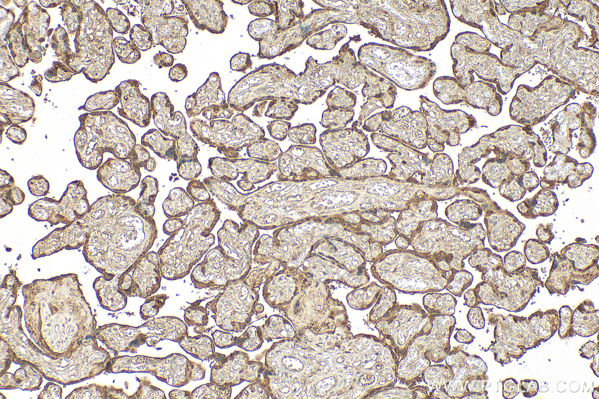 IHC staining of human placenta using 15971-1-AP