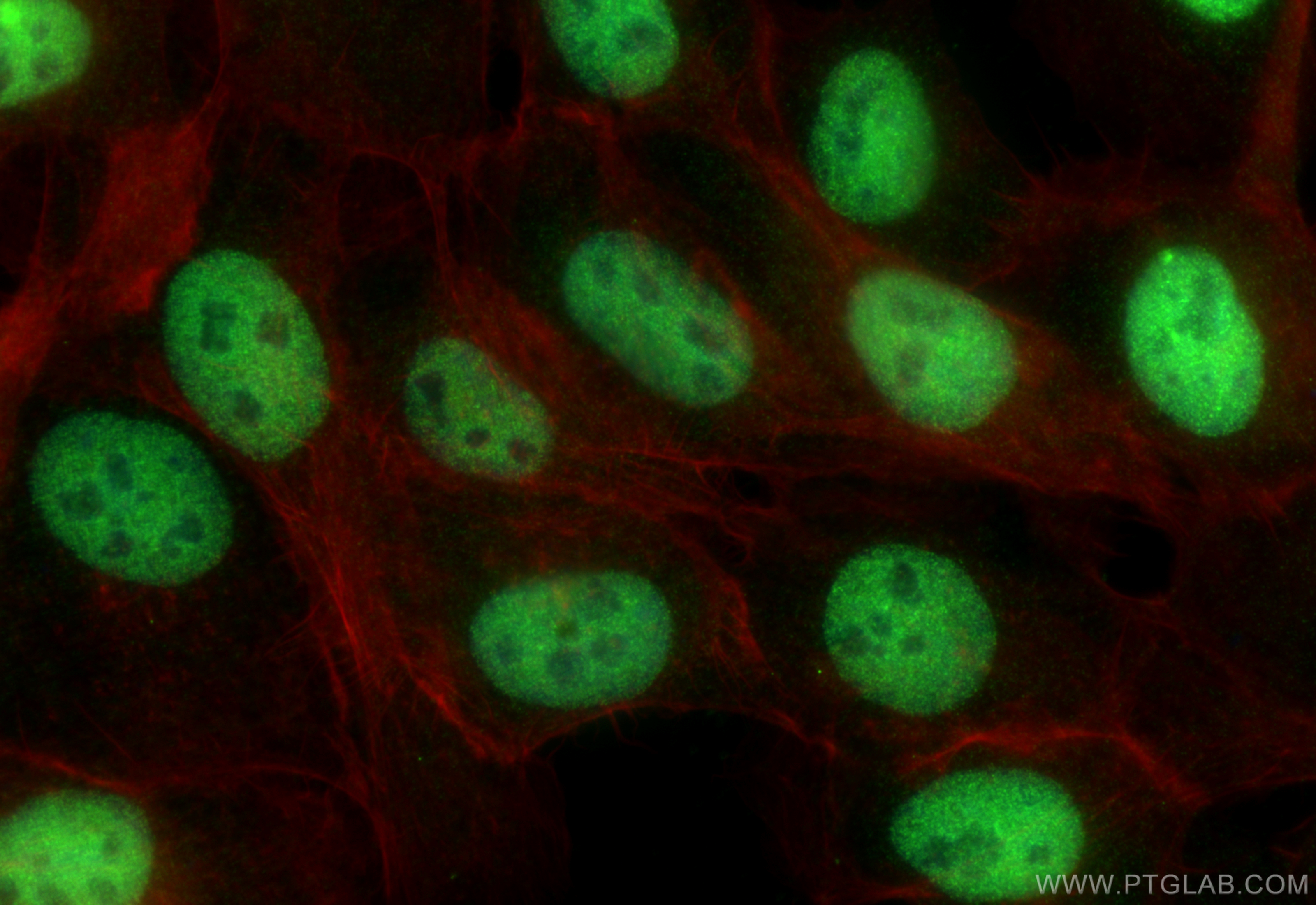 IF Staining of A431 using 84759-4-RR (same clone as 84759-4-PBS)