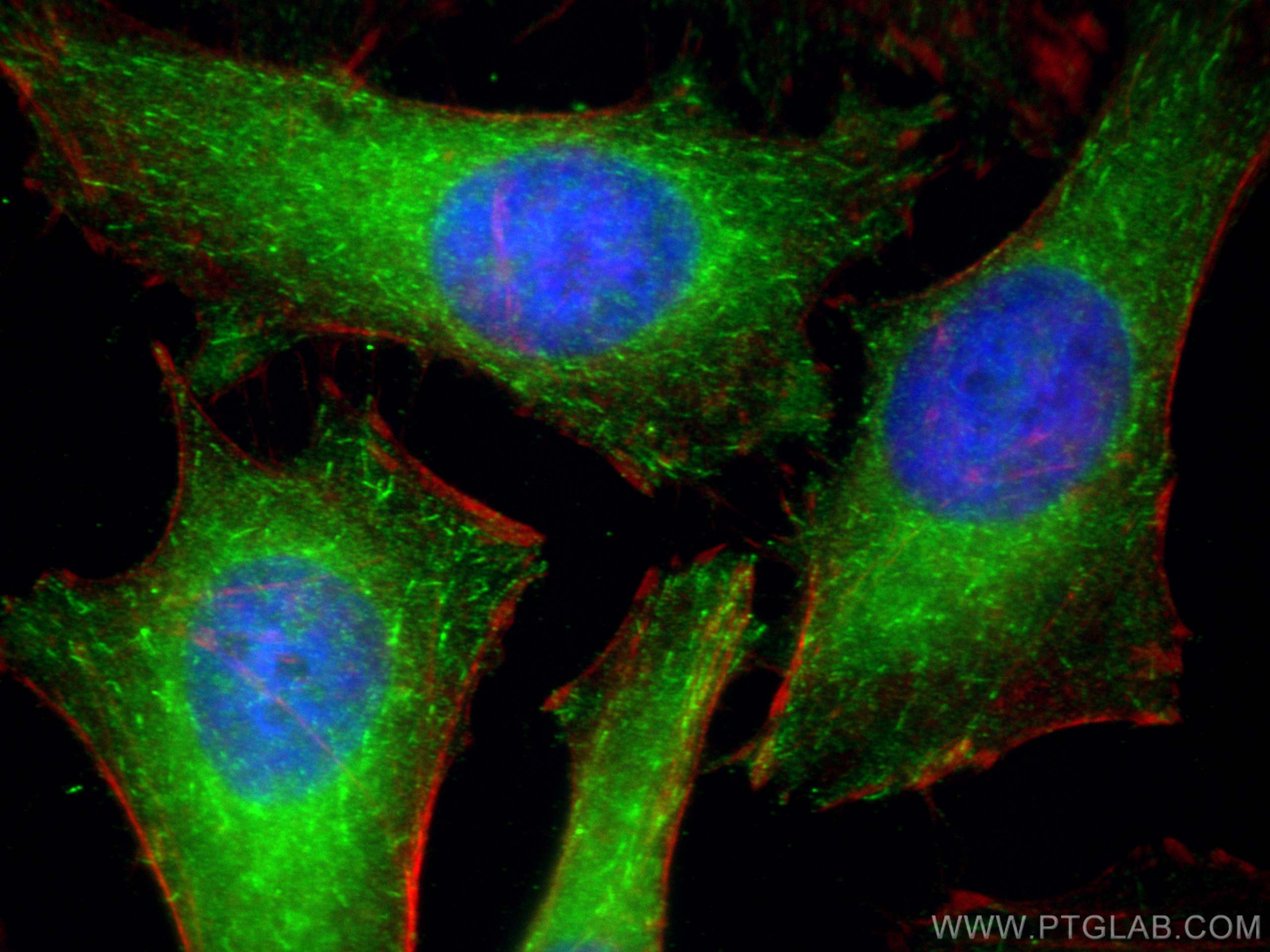 IF Staining of HeLa using 23839-1-AP