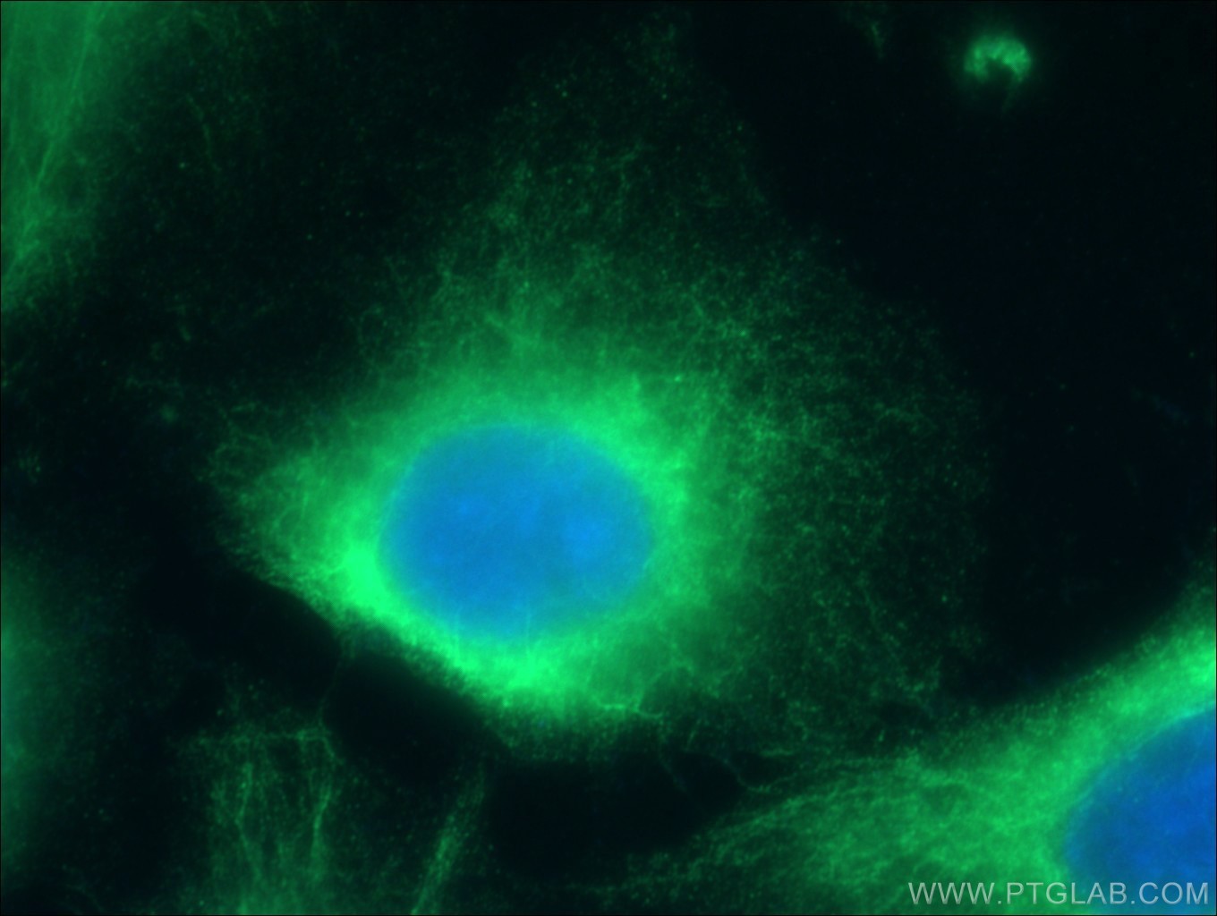 IF Staining of HUVEC using 17044-1-AP