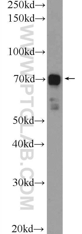 WB analysis of HUVEC using 17044-1-AP