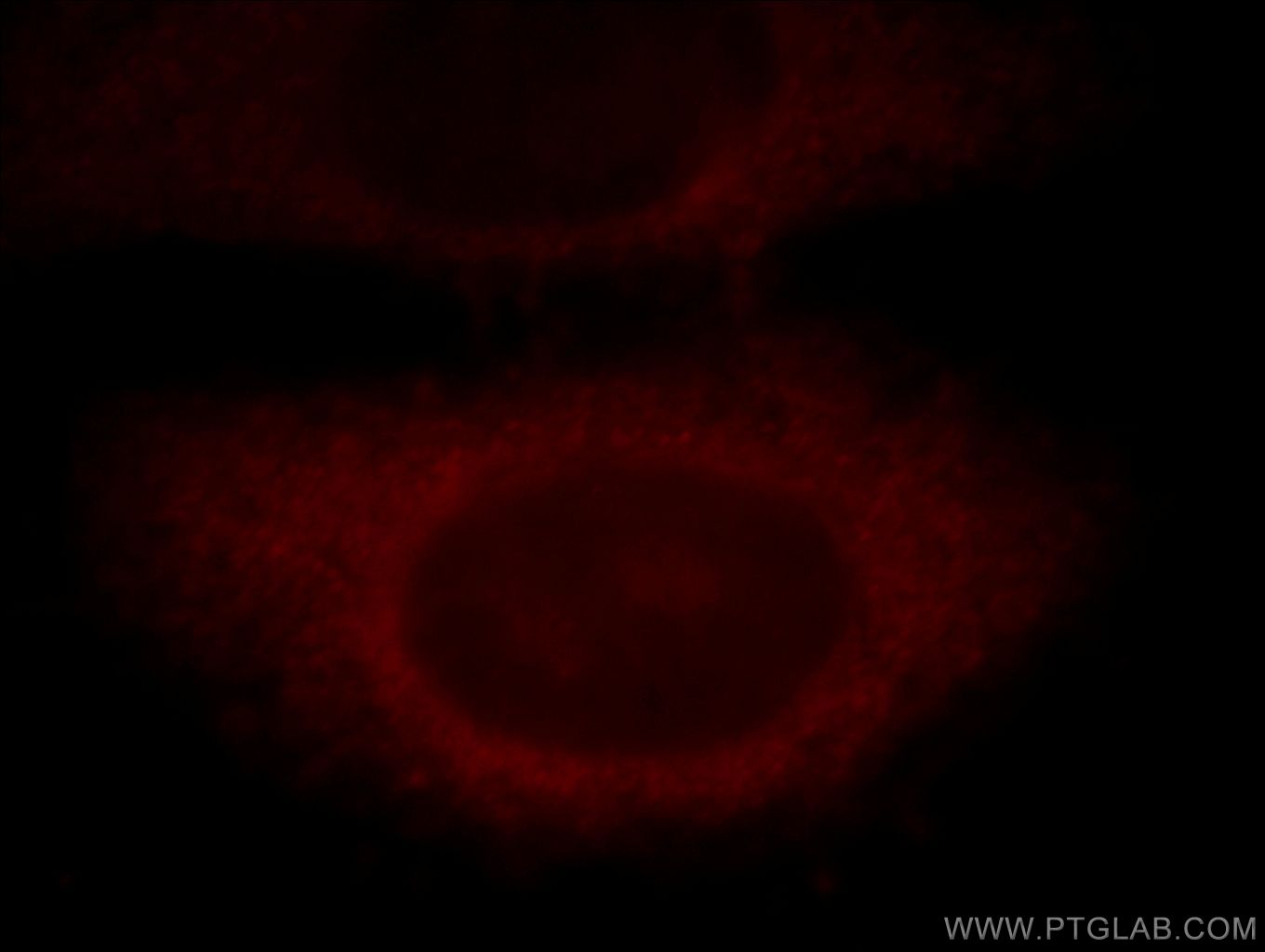 IF Staining of HepG2 using 20386-1-AP