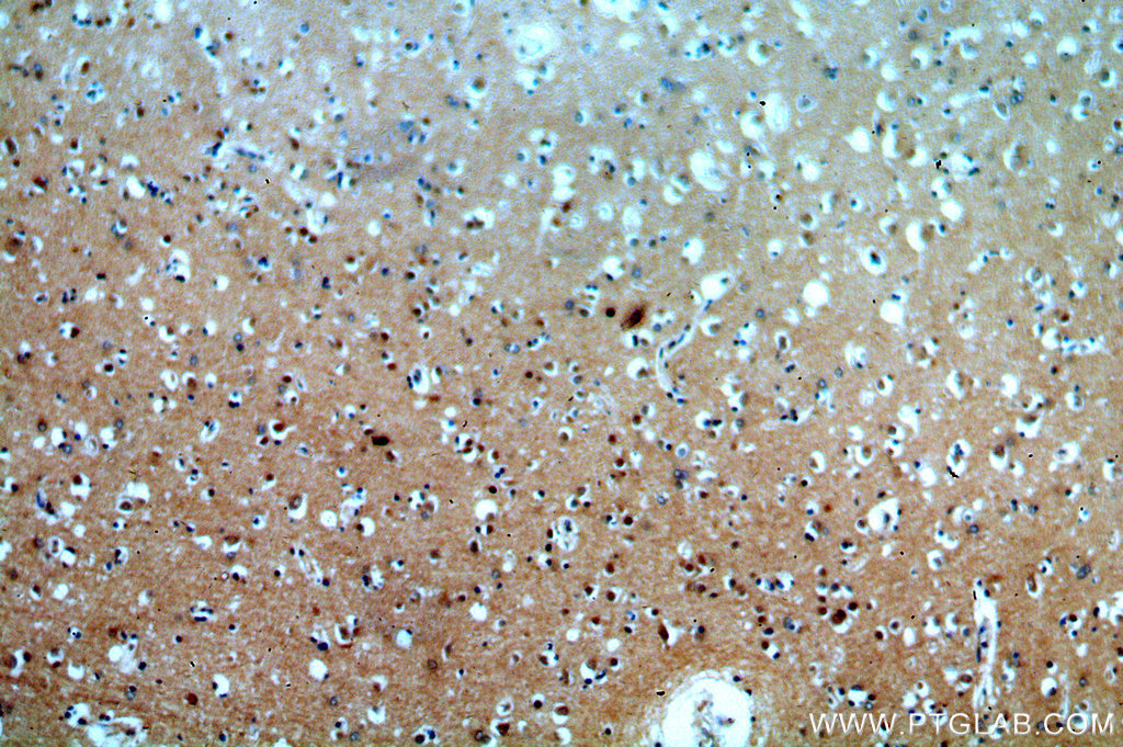 IHC staining of human brain using 20386-1-AP