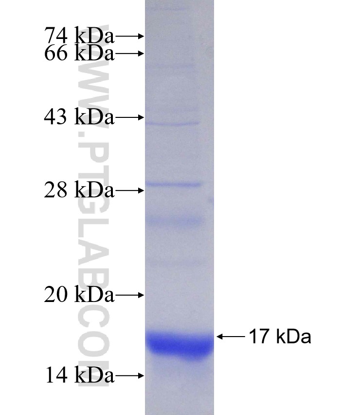 CLN3 fusion protein Ag31402 SDS-PAGE