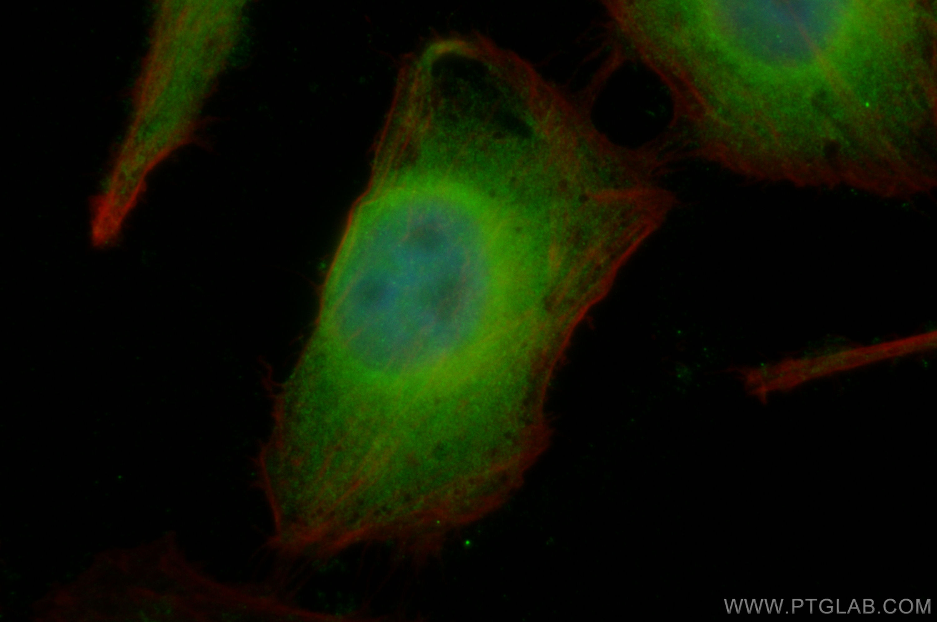 IF Staining of HeLa using 30680-1-AP