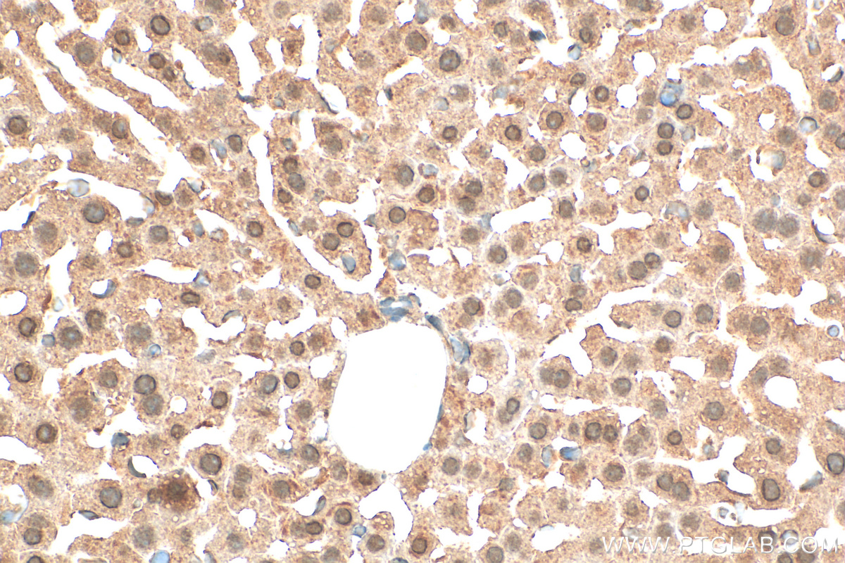 IHC staining of mouse liver using 30680-1-AP