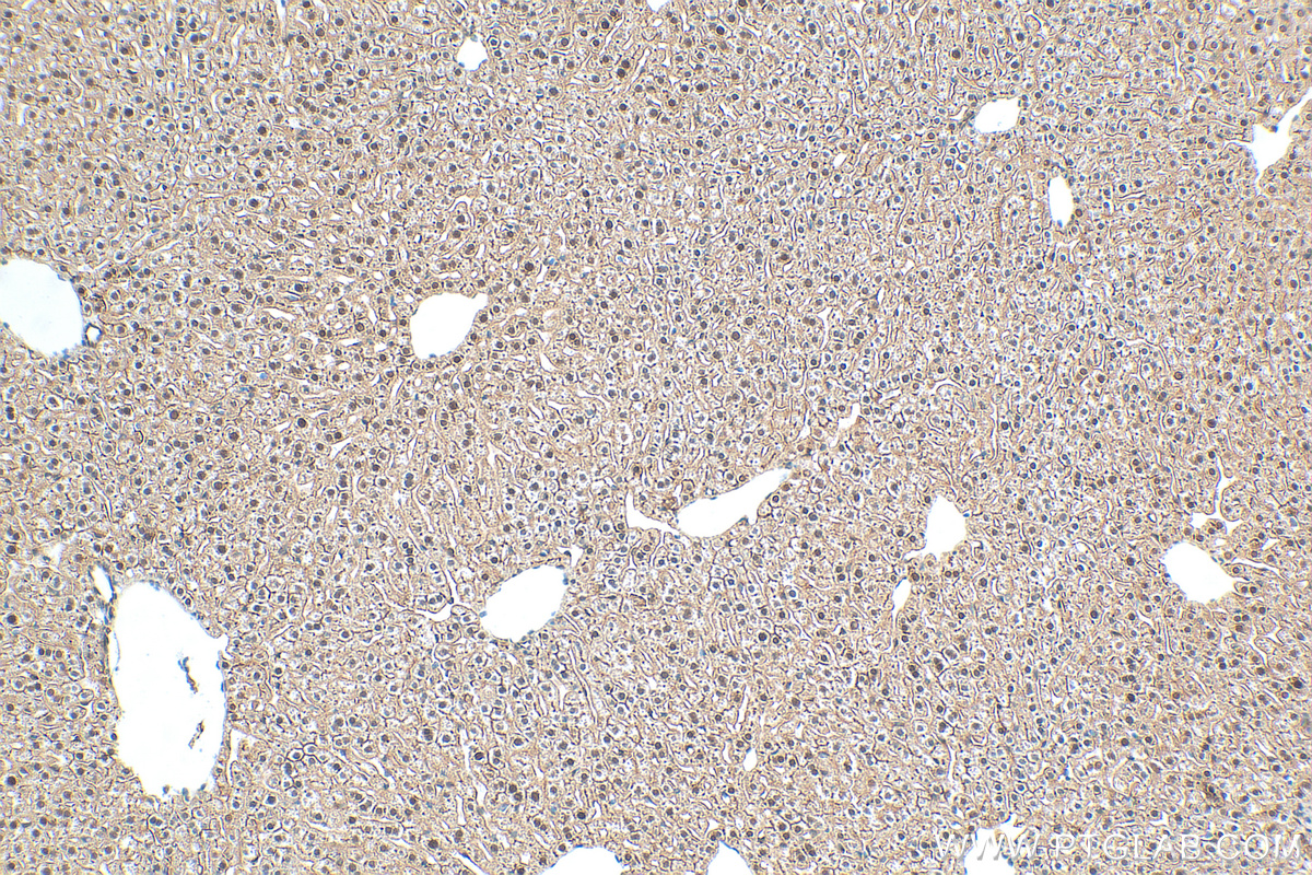 IHC staining of mouse liver using 82829-1-RR (same clone as 82829-1-PBS)