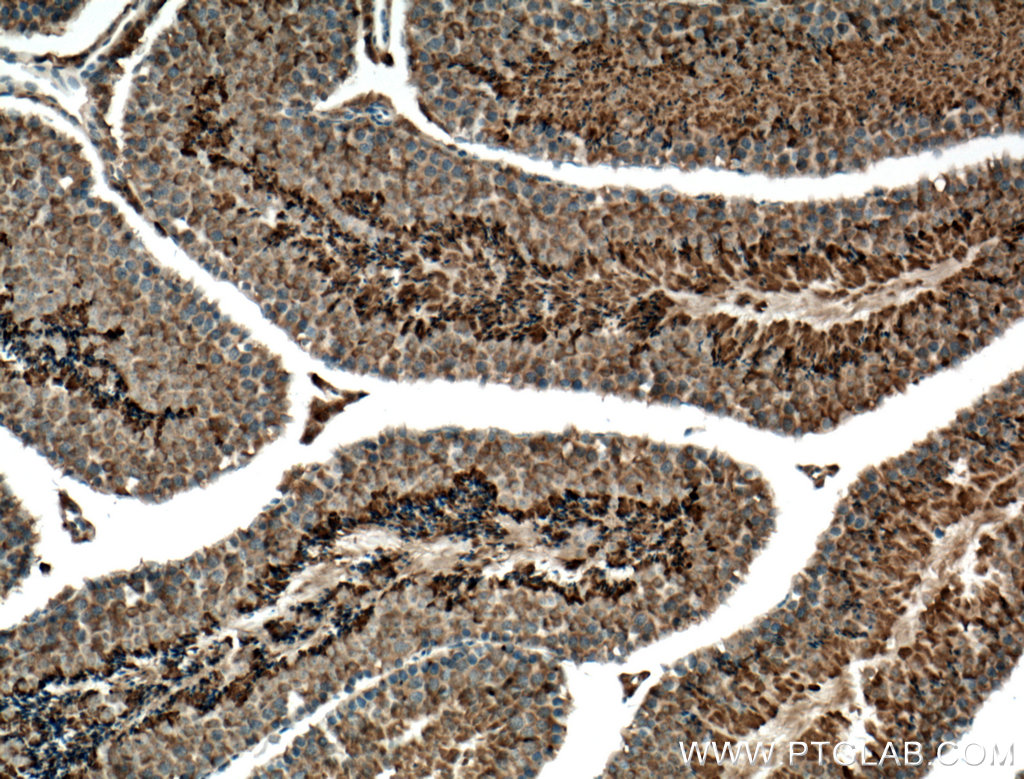 IHC staining of mouse testis using 26630-1-AP