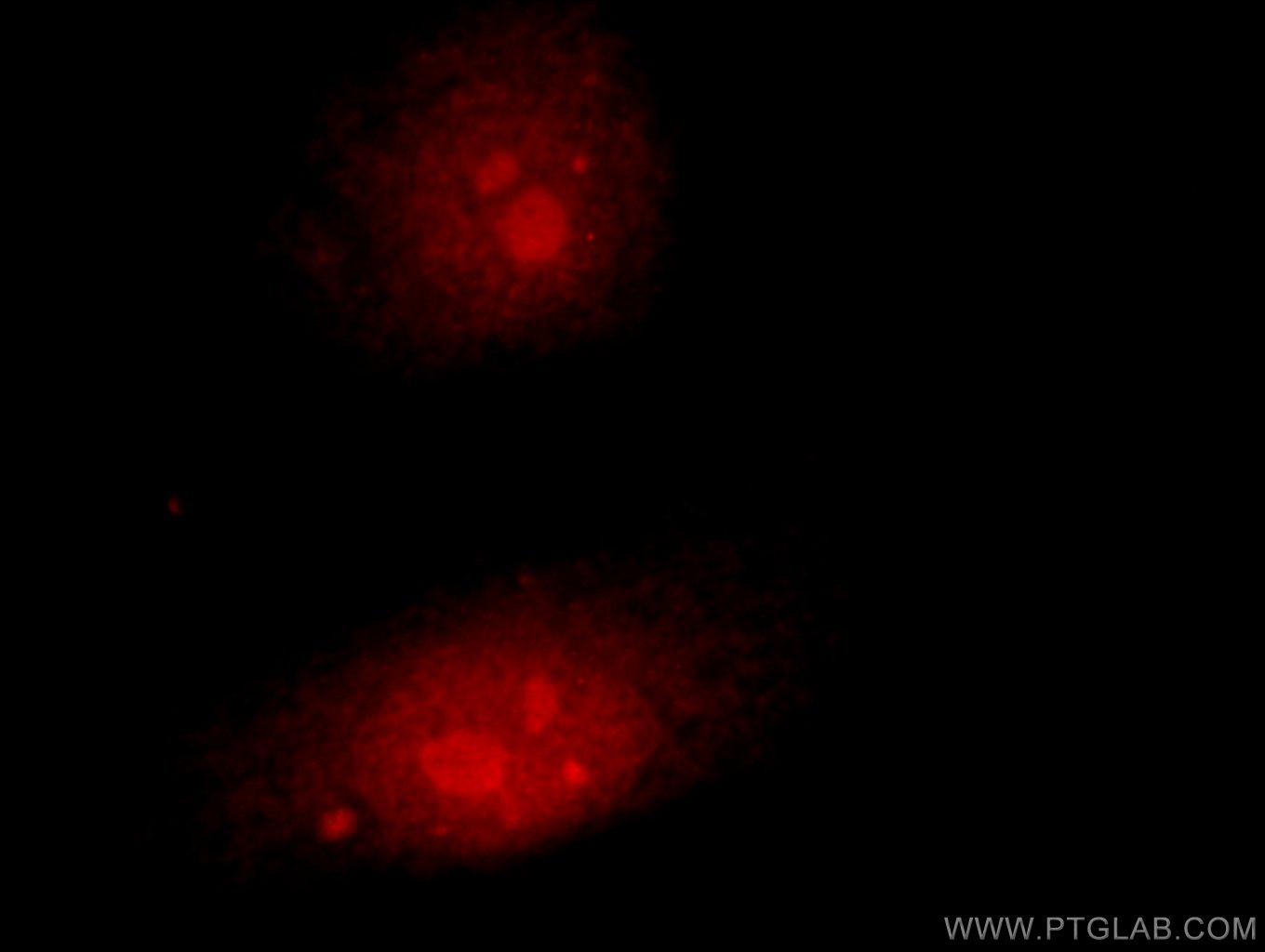 IF Staining of HepG2 using 23206-1-AP