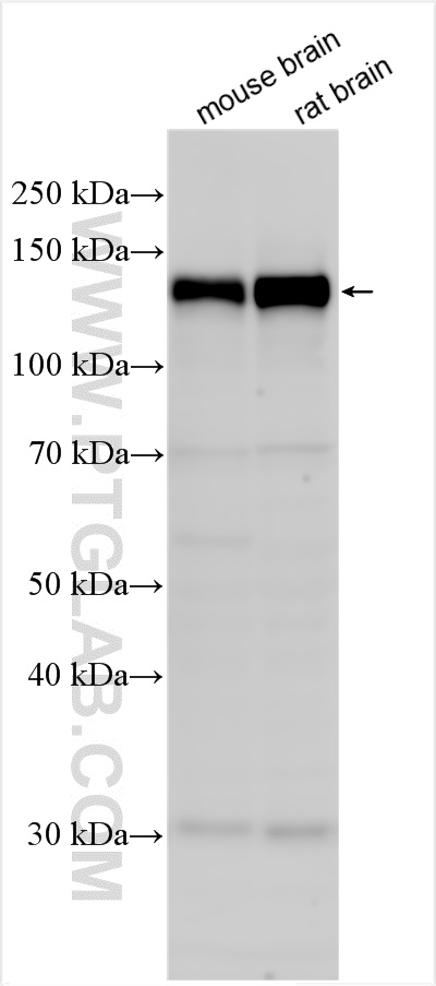 WB analysis using 13302-1-AP