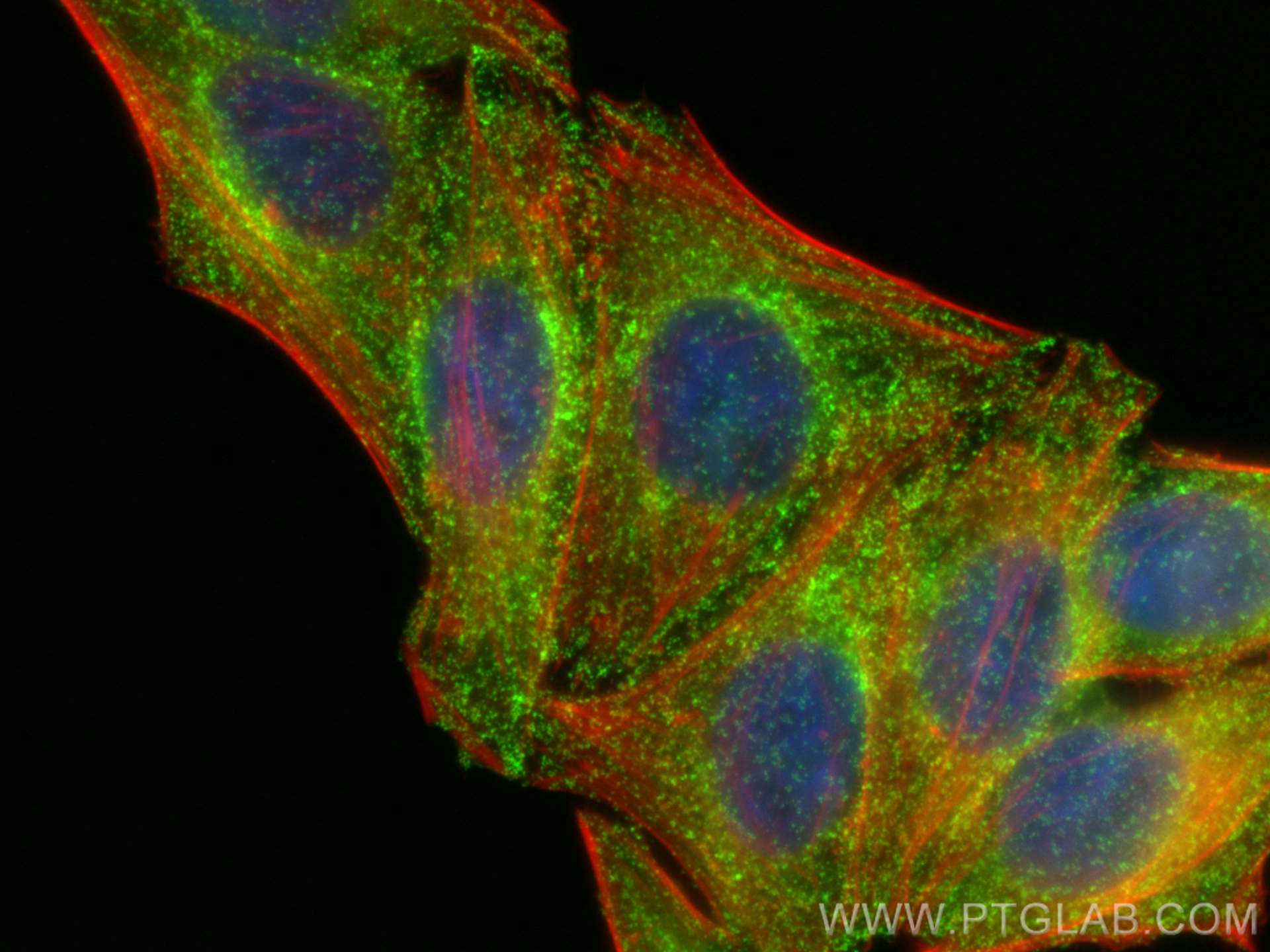 IF Staining of HepG2 using 10852-1-AP