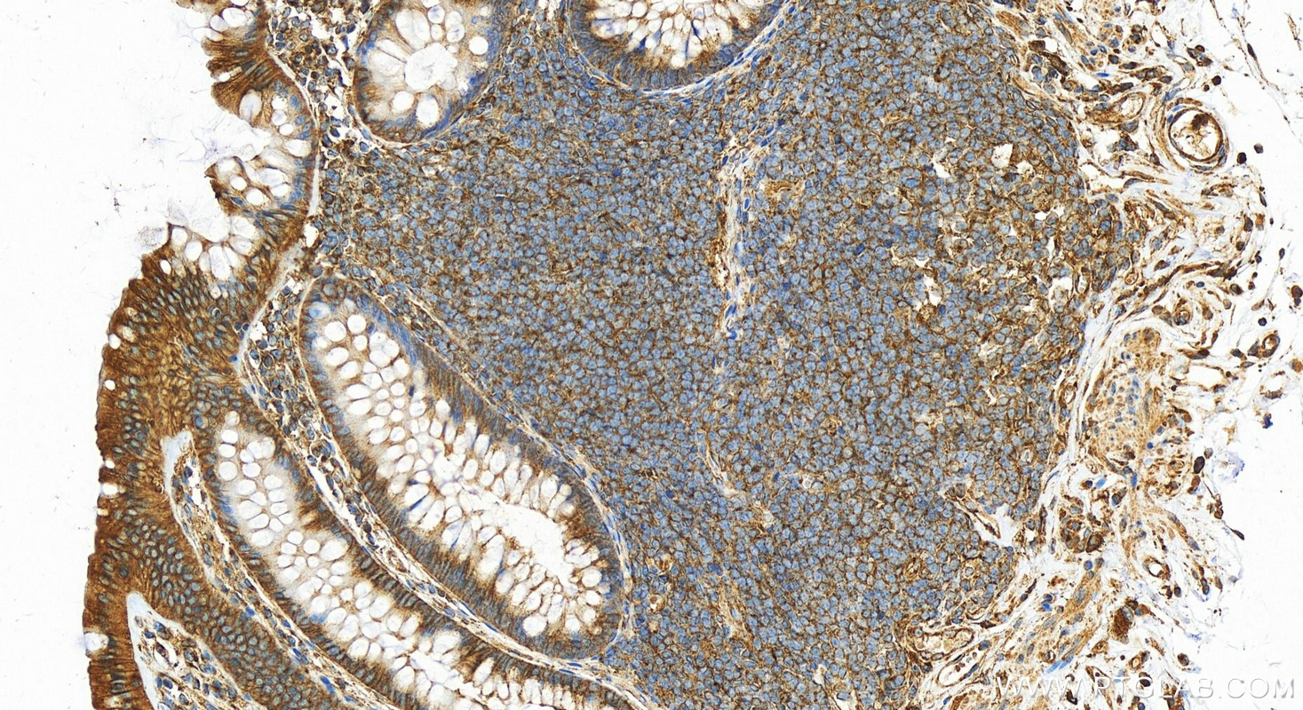 IHC staining of human colon using 26523-1-AP