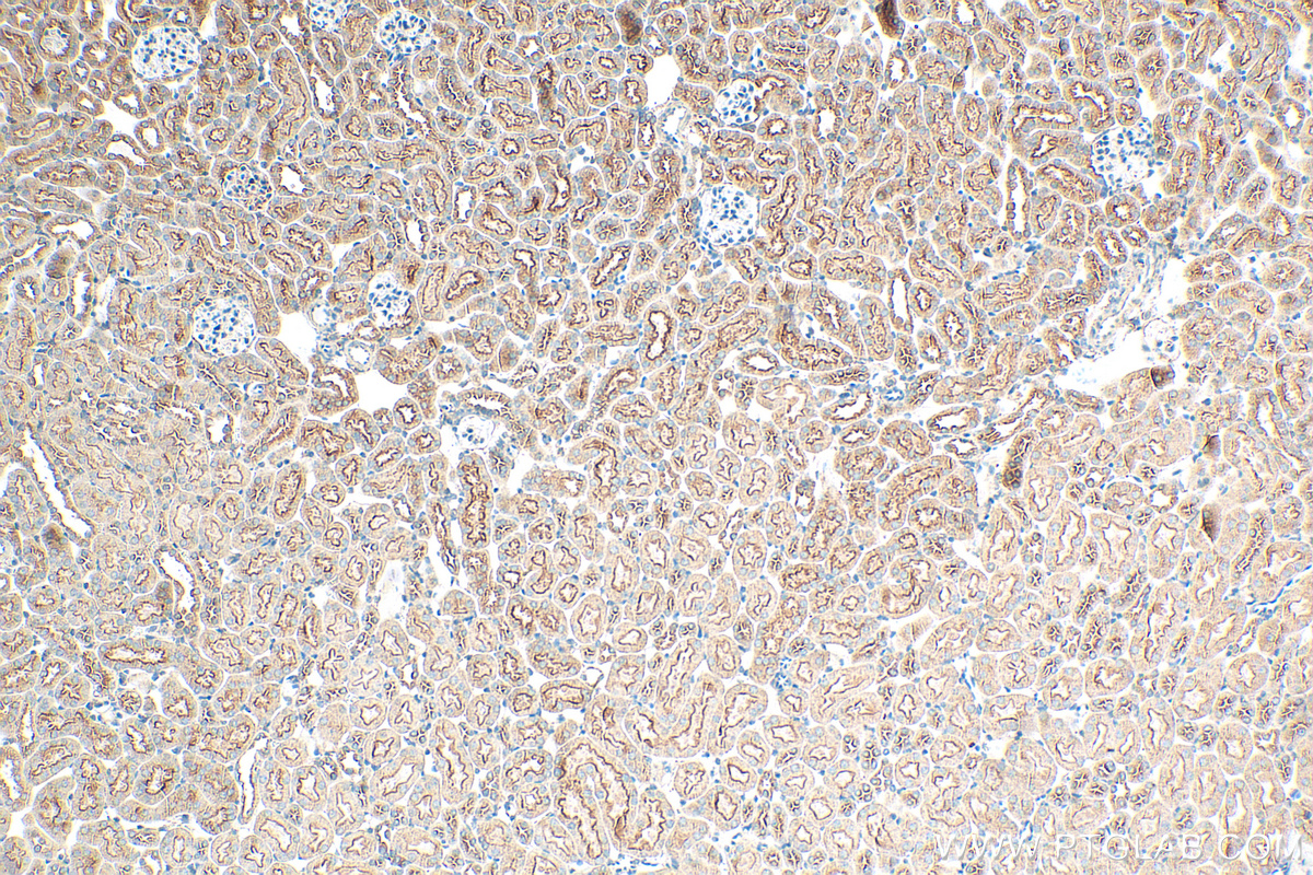IHC staining of mouse kidney using 66487-1-Ig (same clone as 66487-1-PBS)