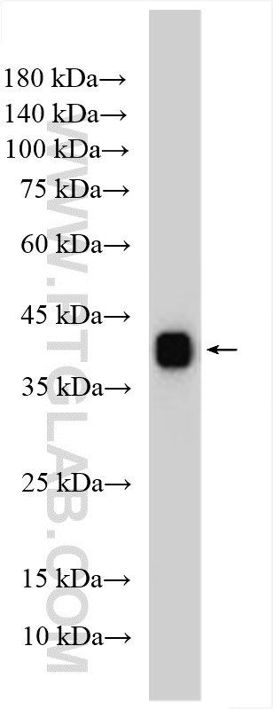 WB analysis of human plasma using 12289-1-AP