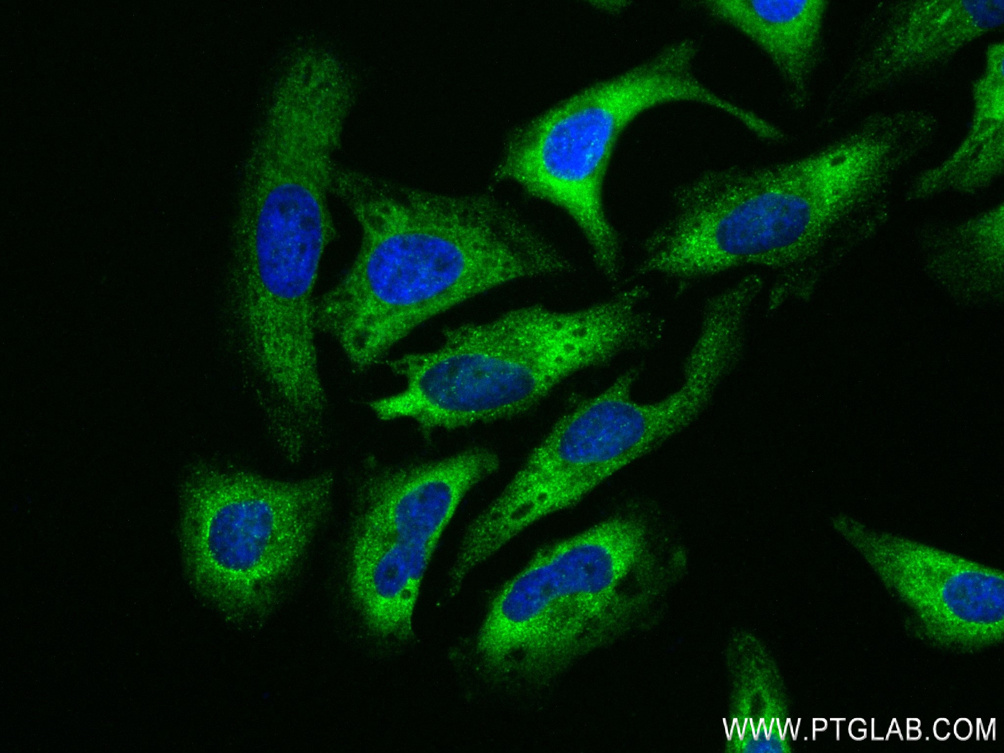 IF Staining of HeLa using 84321-4-RR