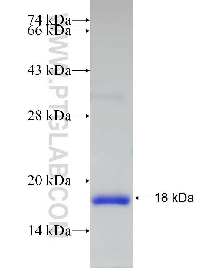 CMC1 fusion protein Ag21231 SDS-PAGE