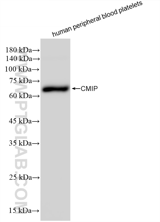 WB analysis of human peripheral blood platelets using 83381-1-RR (same clone as 83381-1-PBS)