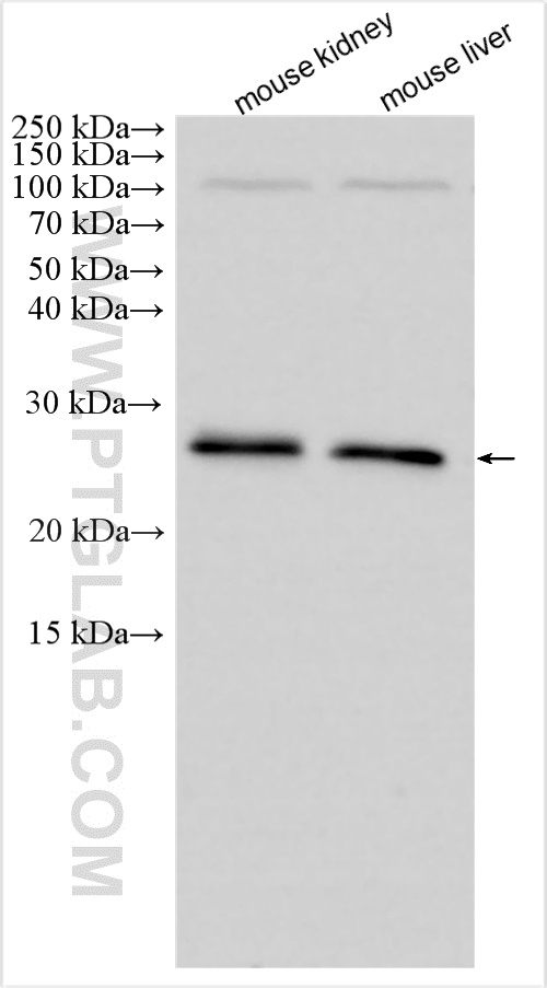 CMTM4