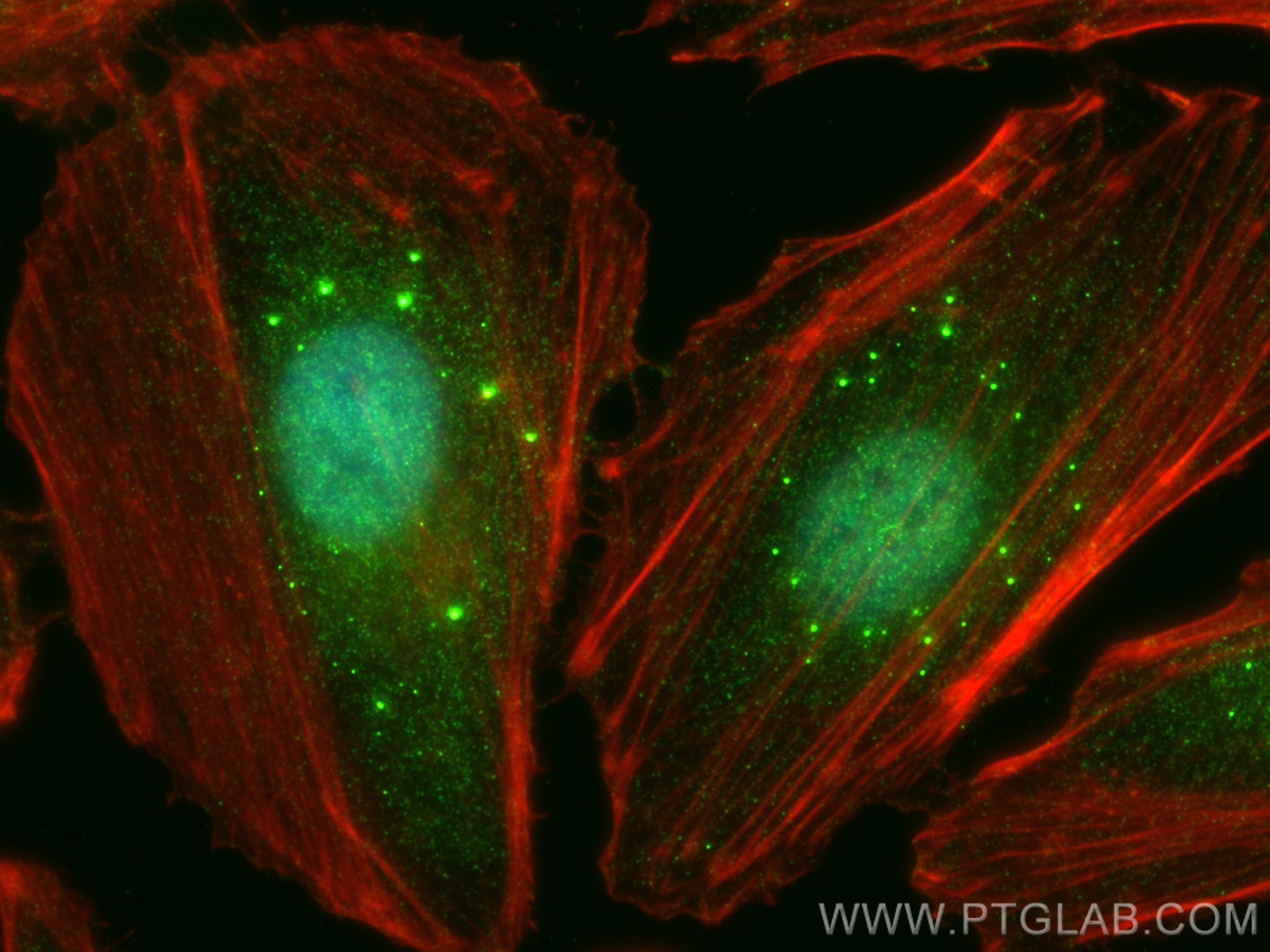 IF Staining of HeLa using 12103-1-AP