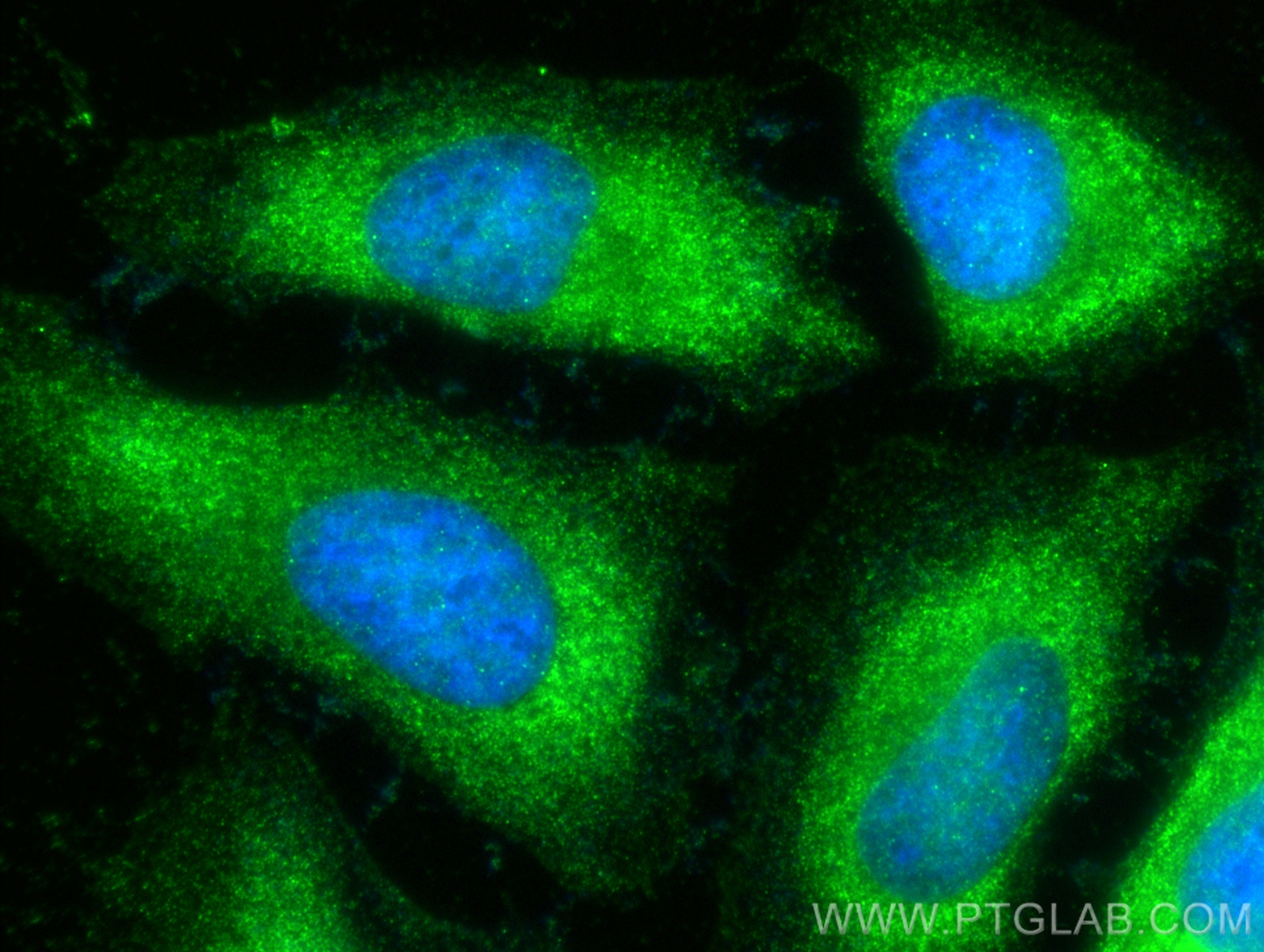 IF Staining of HeLa using 14925-1-AP