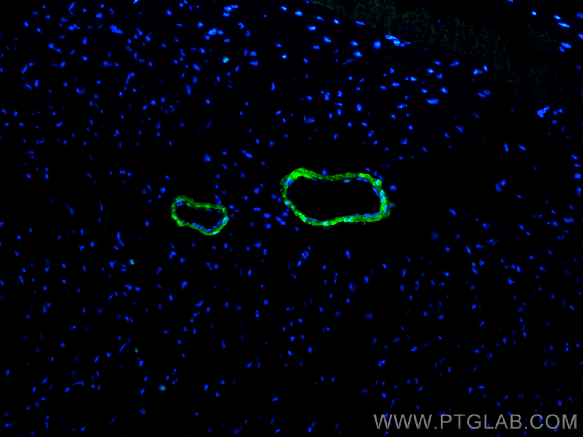 IF Staining of mouse heart using 13938-1-AP