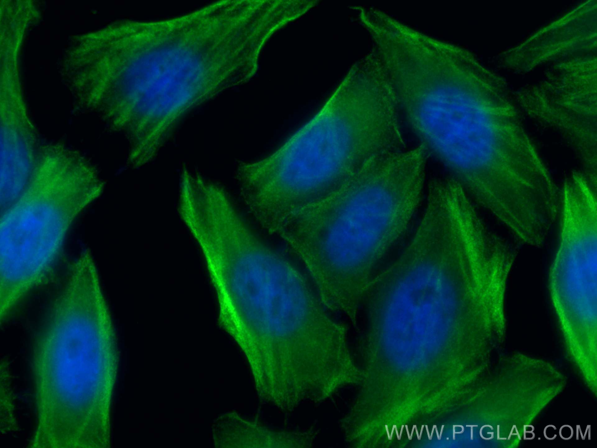 IF Staining of HepG2 using 21073-1-AP