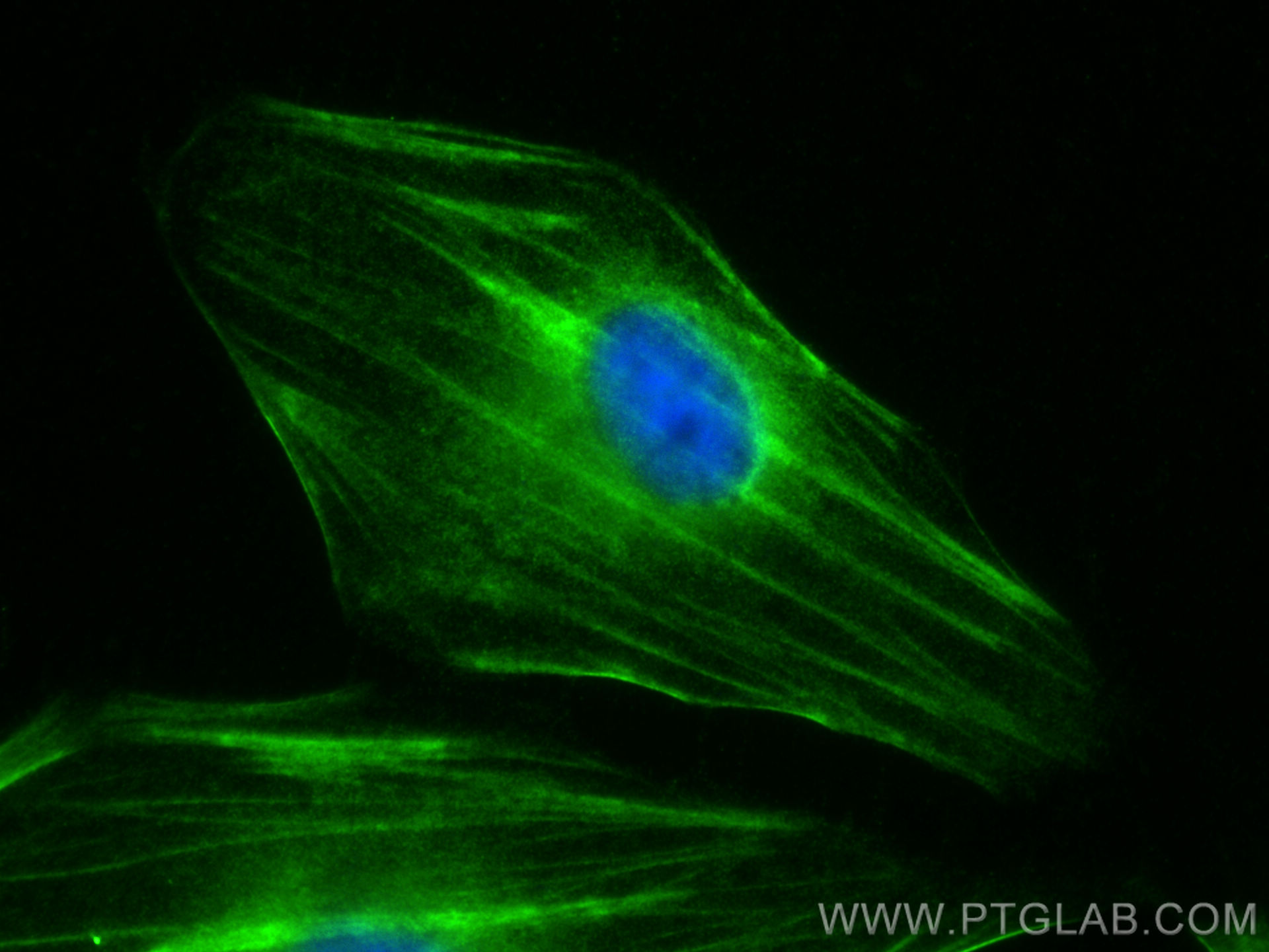 IF Staining of HeLa using 11509-1-AP