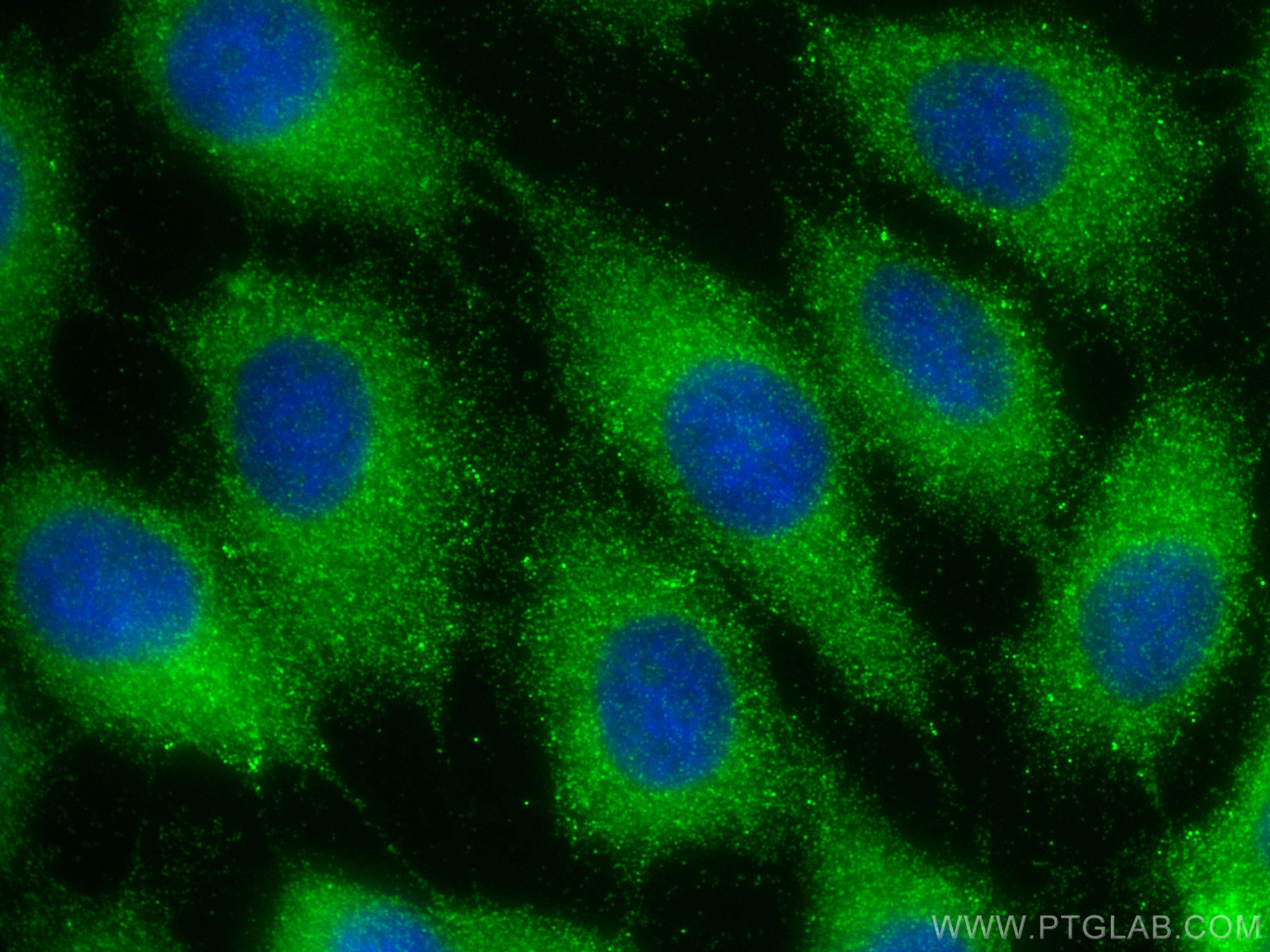 IF Staining of A431 using 13976-1-AP