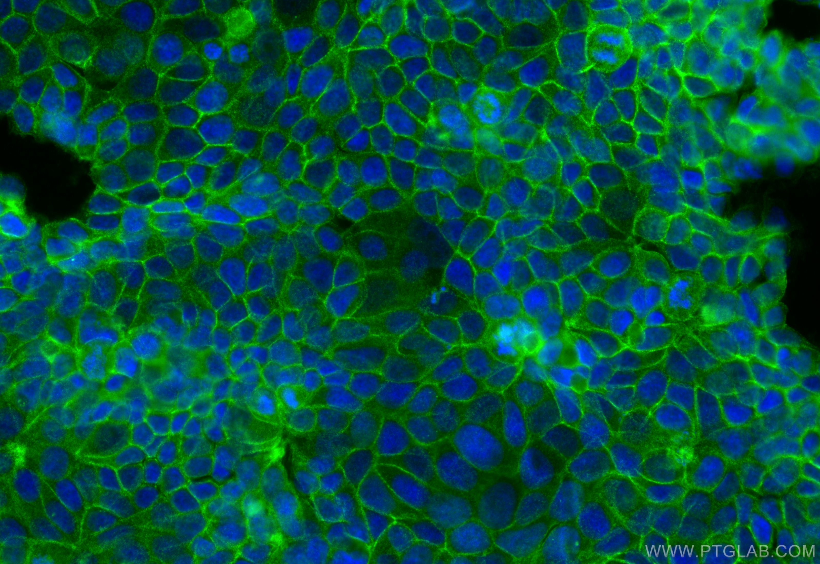 IF Staining of MCF-7 using 14066-1-AP