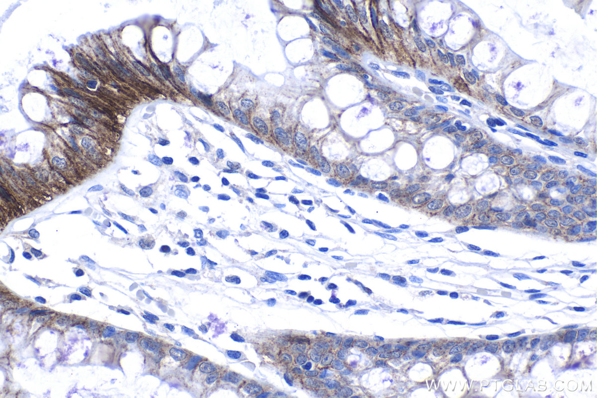 IHC staining of human colon using 14066-1-AP