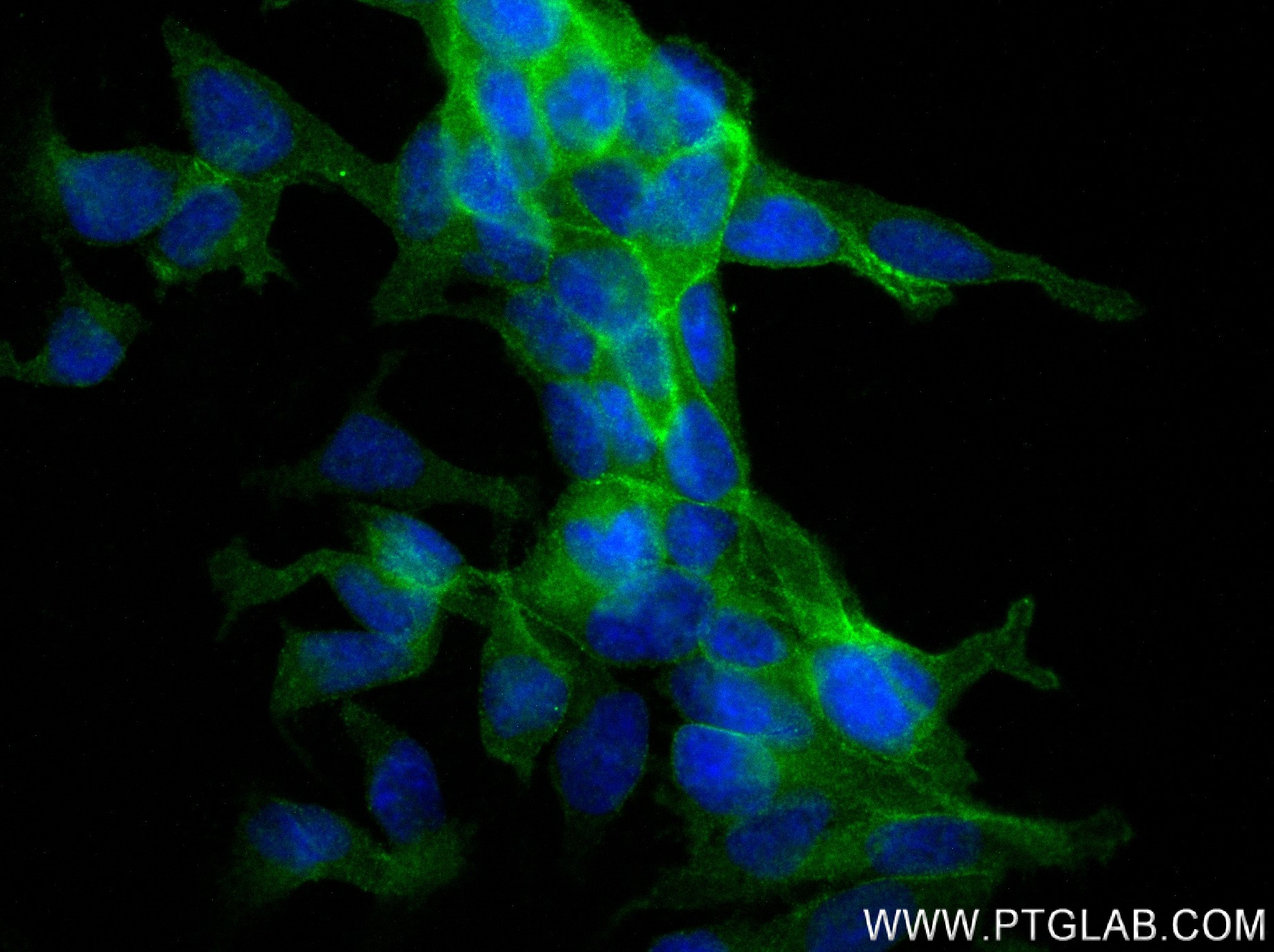 IF Staining of LNCaP using 83824-5-RR (same clone as 83824-5-PBS)