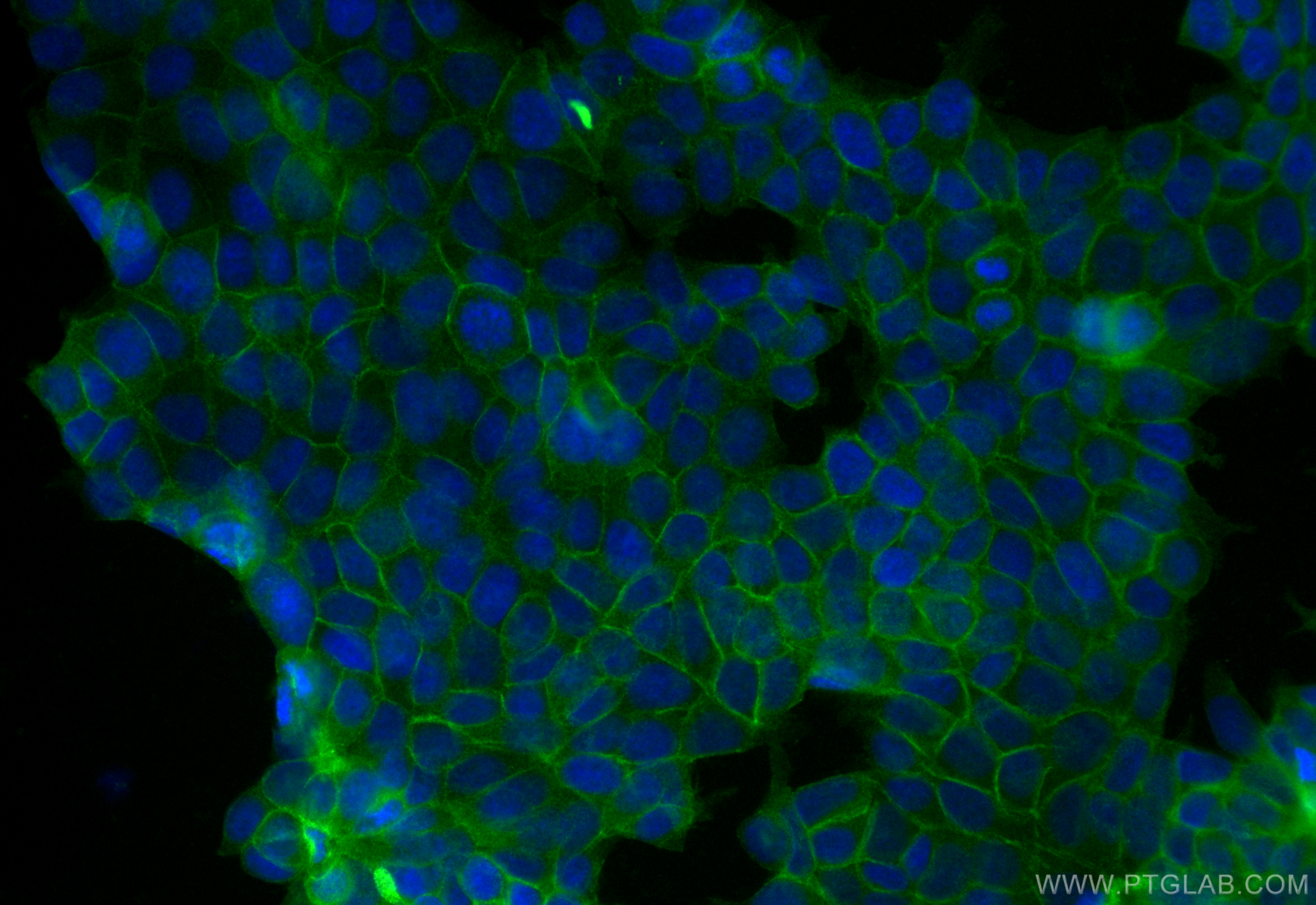 IF Staining of MCF-7 using CL488-83824-5