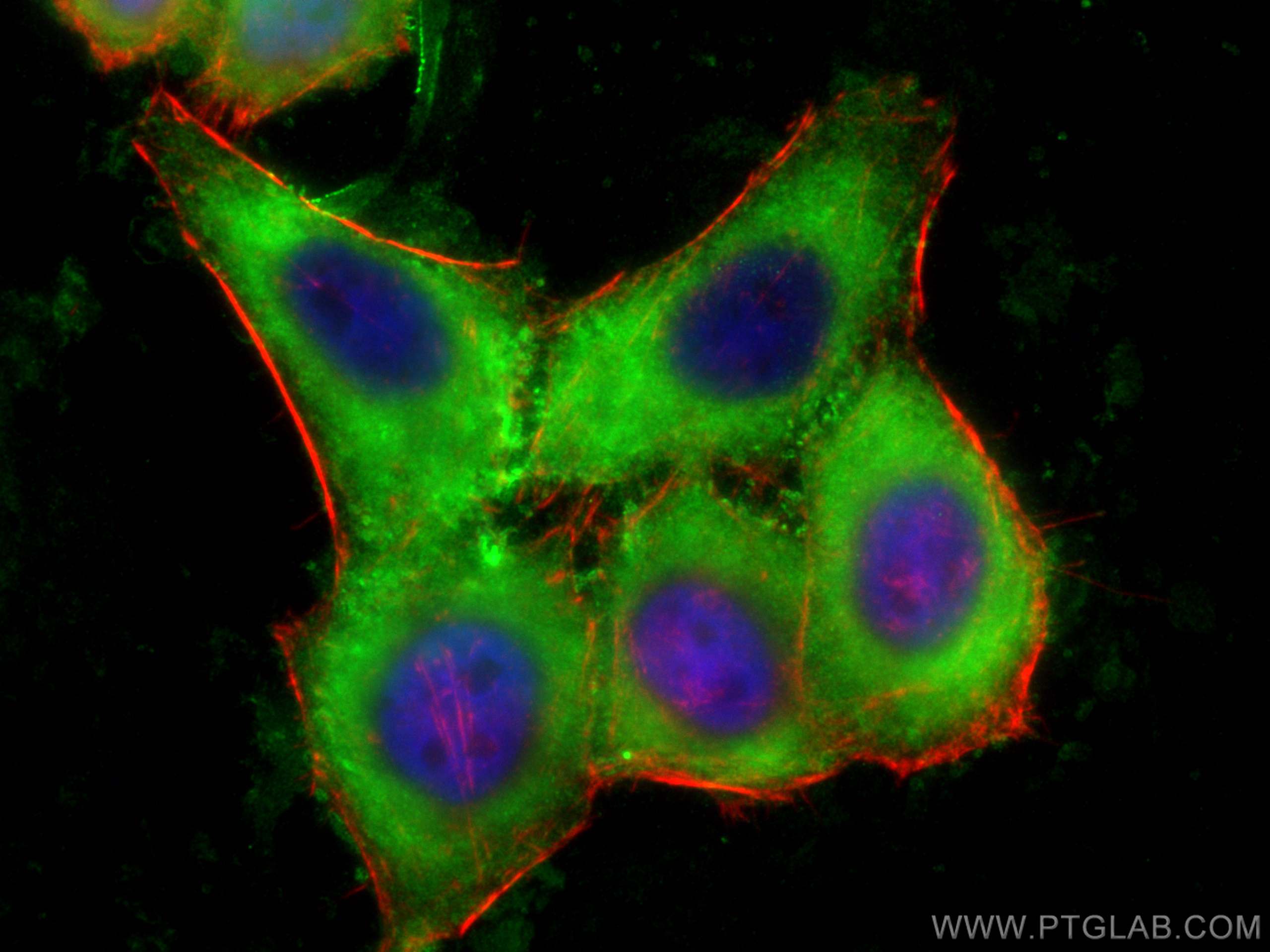 IF Staining of HepG2 using 15938-1-AP