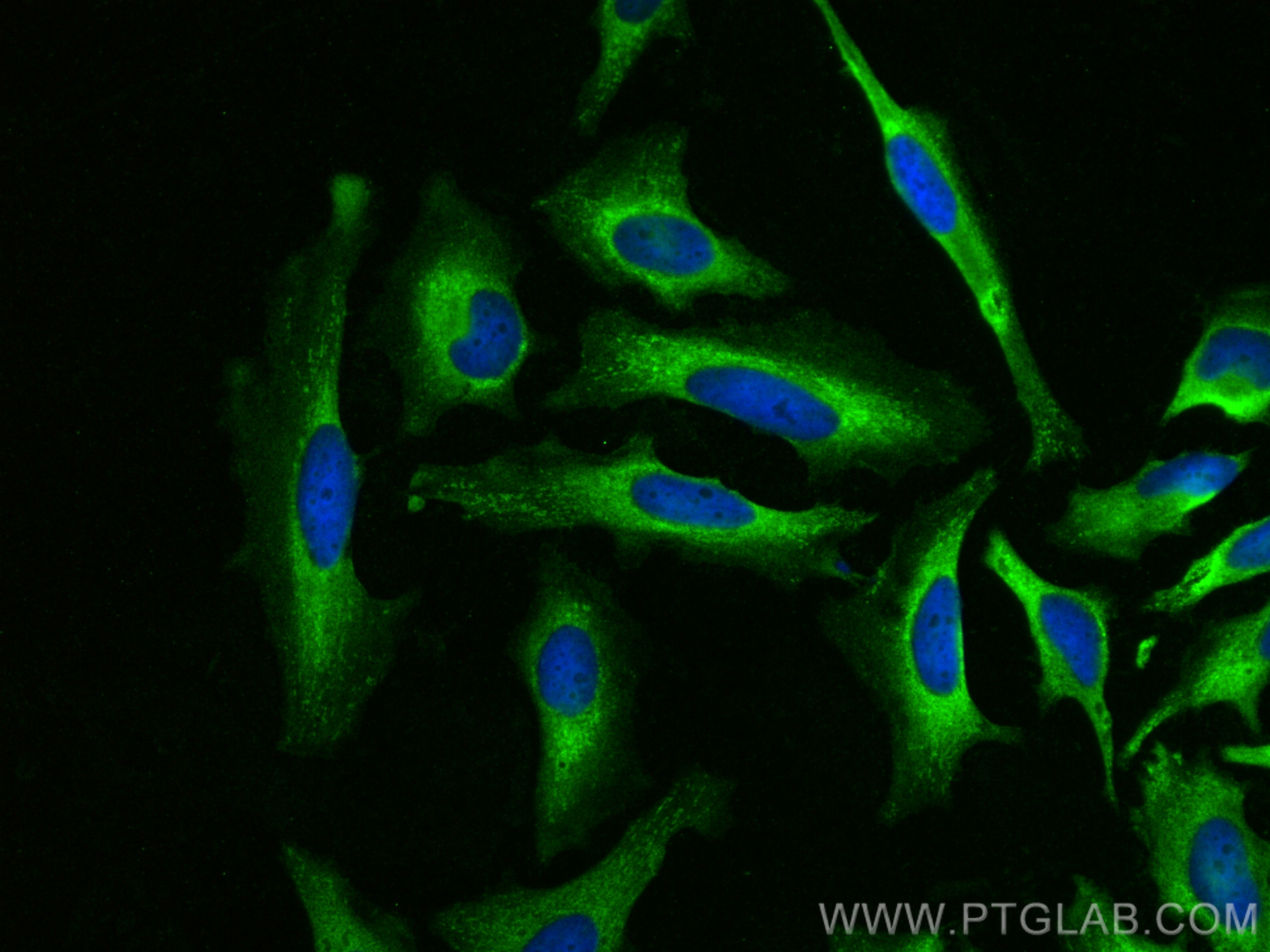 IF Staining of HeLa using 11135-1-AP