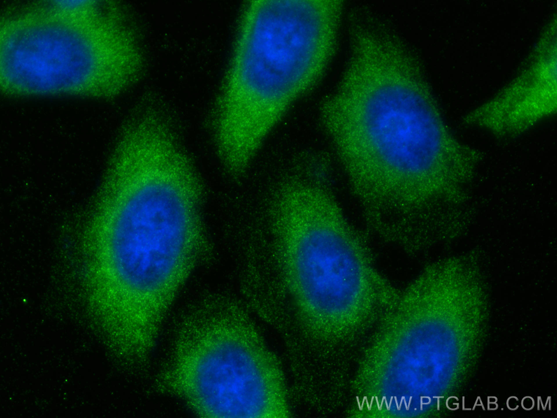 IF Staining of HepG2 using 67798-1-Ig