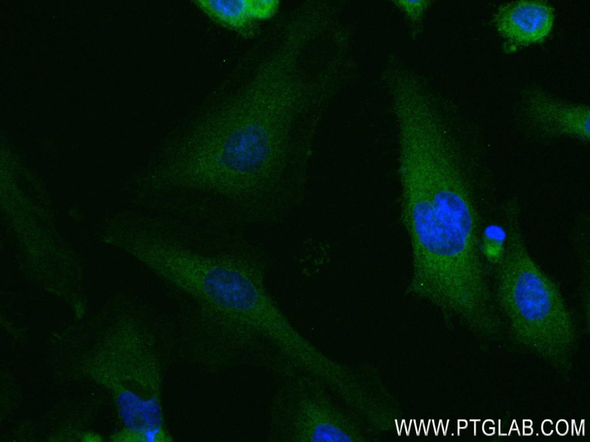 IF Staining of HeLa using 83615-4-RR (same clone as 83615-4-PBS)