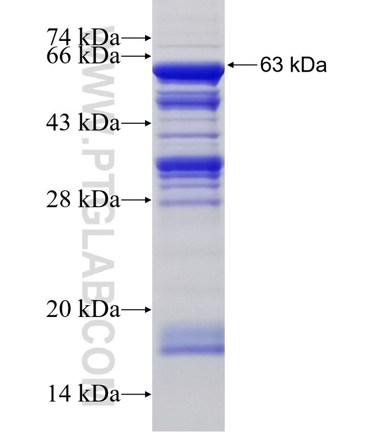 CNOT4 fusion protein Ag3163 SDS-PAGE