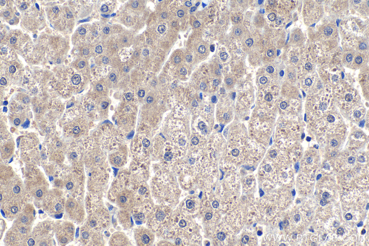 IHC staining of human liver using 68358-1-Ig (same clone as 68358-1-PBS)
