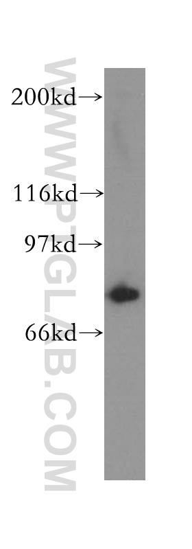 WB analysis of Y79 using 13552-1-AP