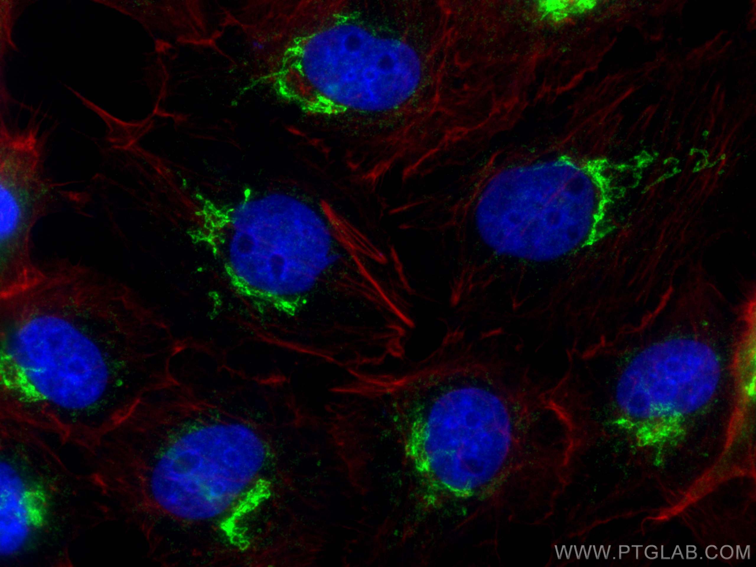 IF Staining of A431 using 12661-1-AP