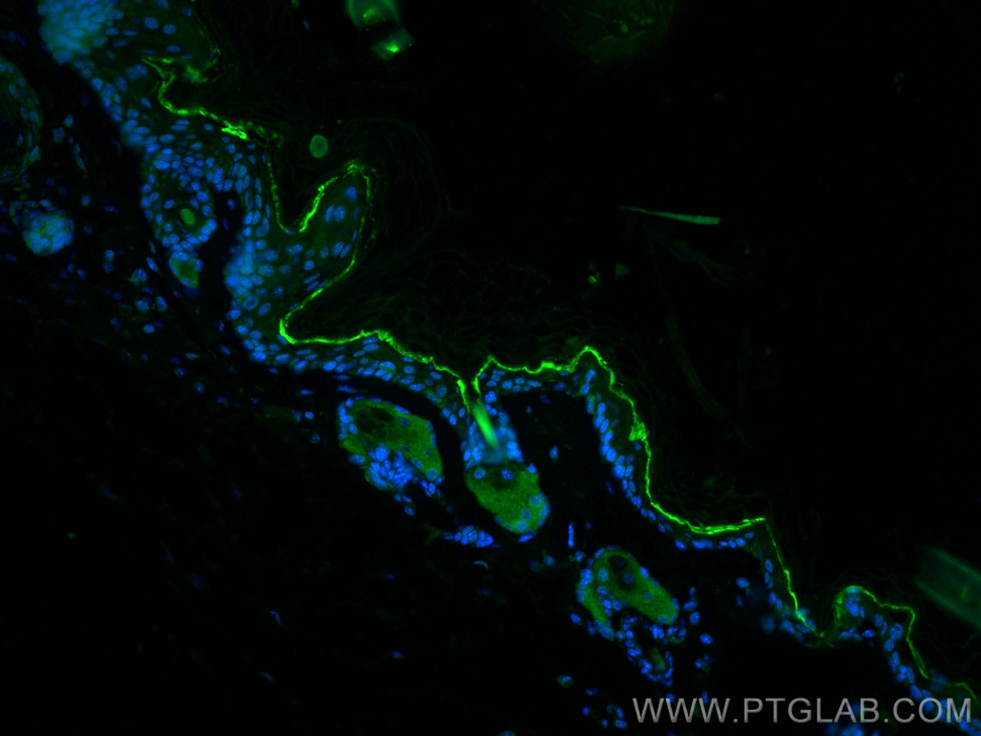 IF Staining of mouse skin using 19802-1-AP