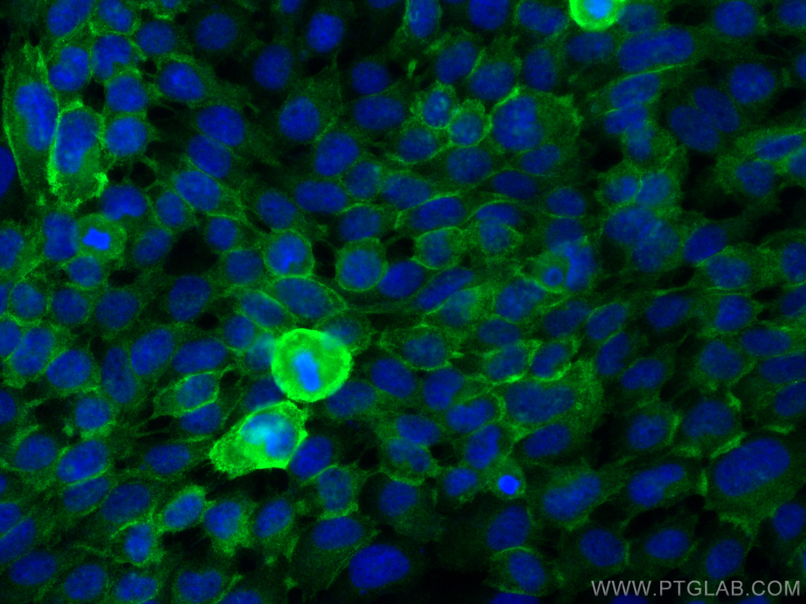 IF Staining of A431 using 31190-1-AP